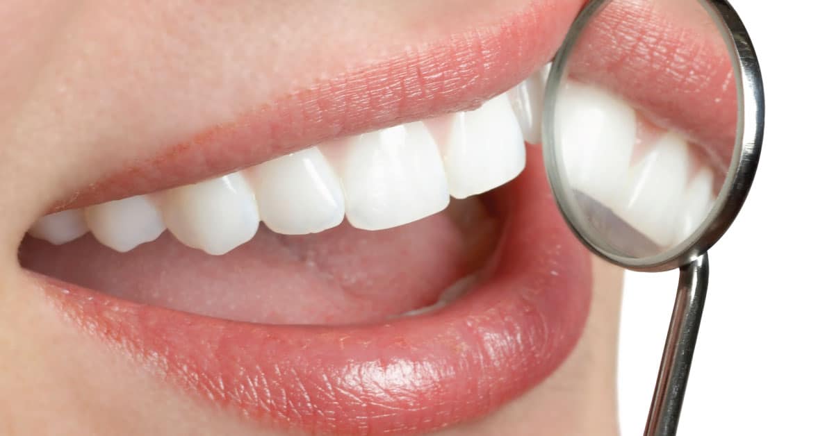 Teeth Whitening Billings MT