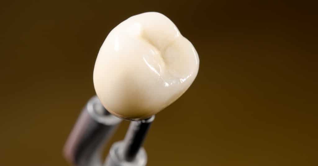 Dental Crowns Why You Want to Replace the Temporary Crown in a Timely