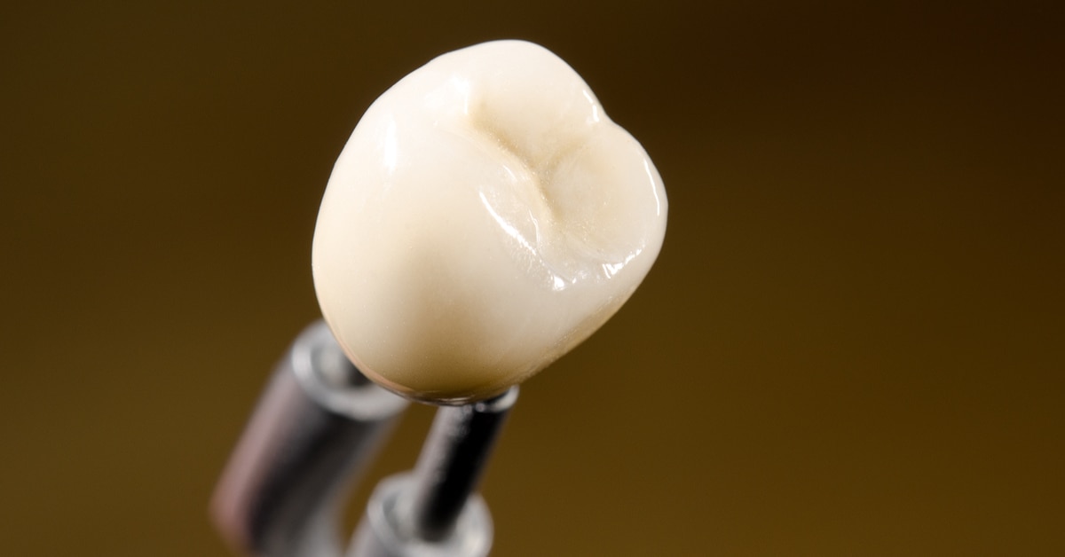 Dental Crowns: Why You Want to Replace the Temporary Crown in a Timely Manner