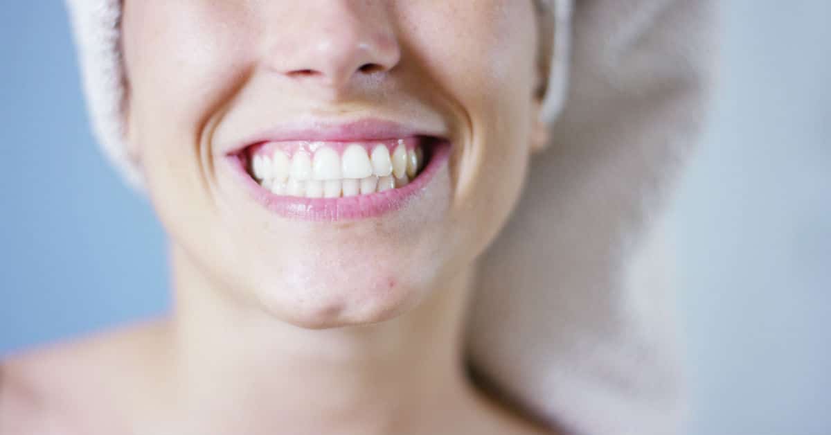 Having Your Teeth Whitened At Bridge Creek Dental