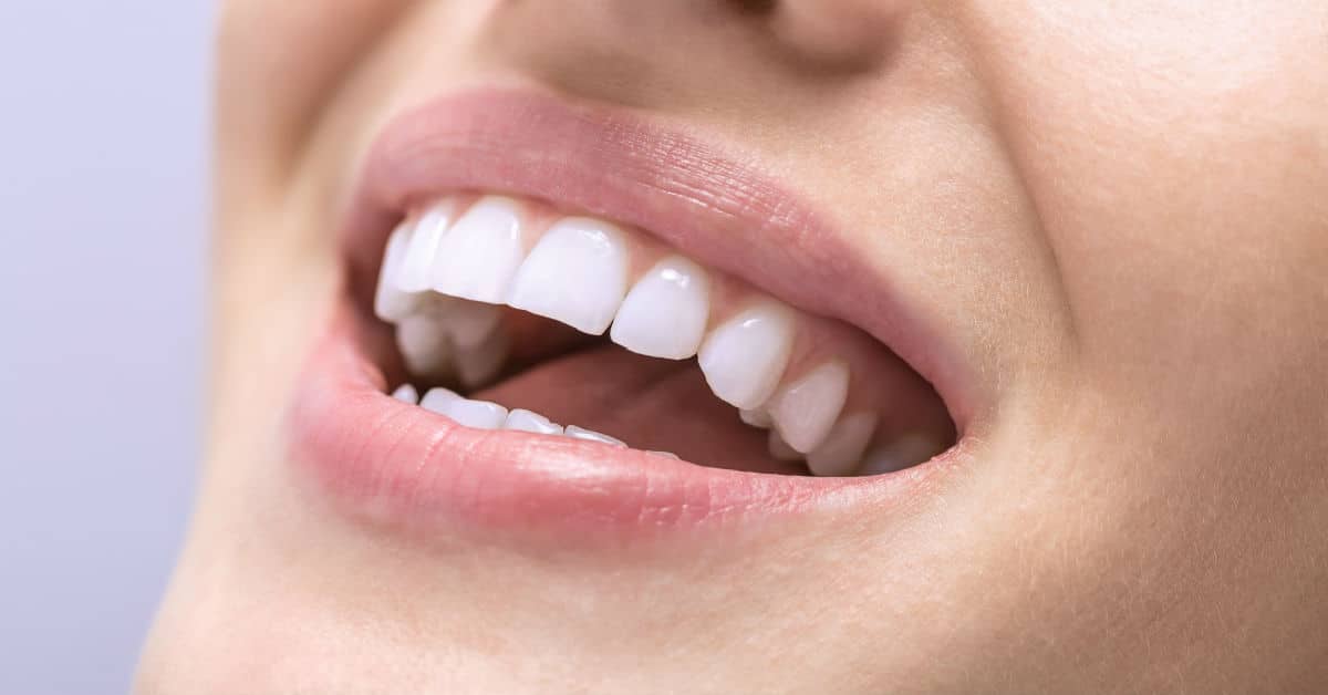 Cosmetic Dentistry Can Fix Crooked Teeth