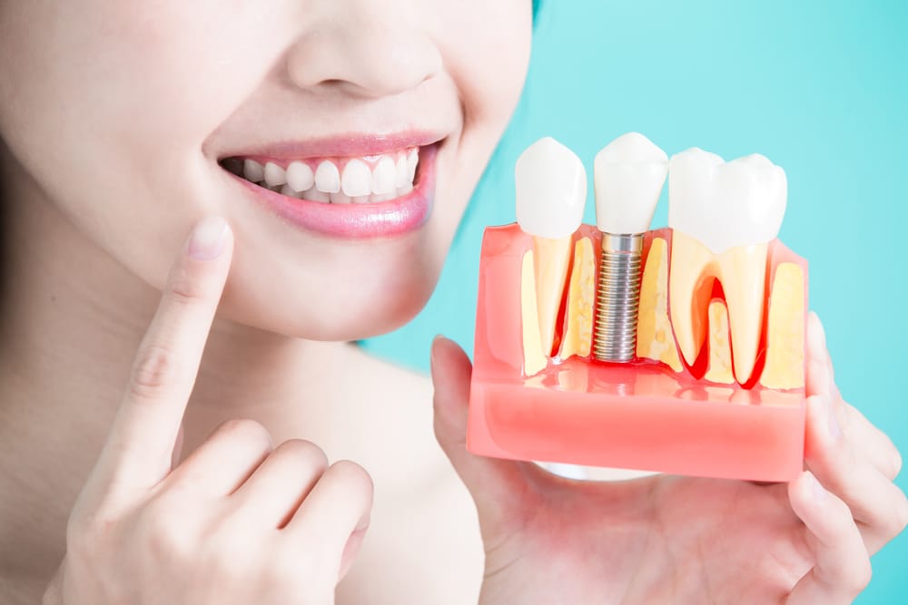 Dentist Digest Monthly: How Long Do Dental Implants Last?