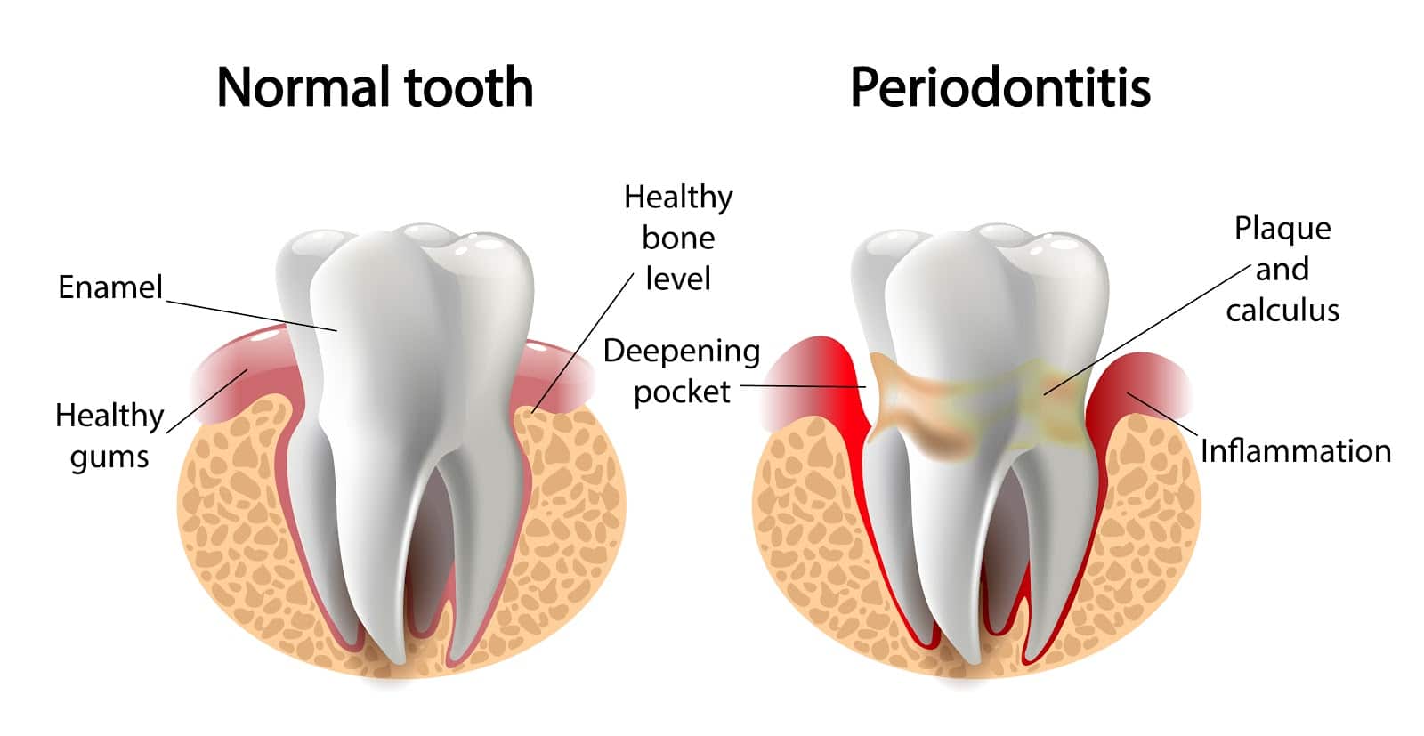 Dental Digest Monthly: It’s Called Gum Disease, But It Affects More Than Your Gums