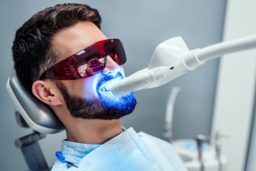 How Teeth Whitening Changes Your Smile